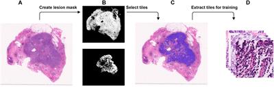 Prediction of BRCA Gene Mutation in Breast Cancer Based on Deep Learning and Histopathology Images